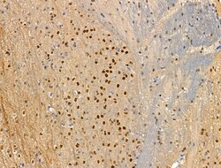 Invitrogen Phospho-ATF6 (Thr166) Polyclonal Antibody 100 &mu;L; Unconjugated:Antibodies,