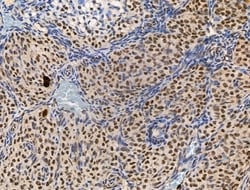 Invitrogen Phospho-ATF6 (Thr166) Polyclonal Antibody 100 &mu;L; Unconjugated:Antibodies,