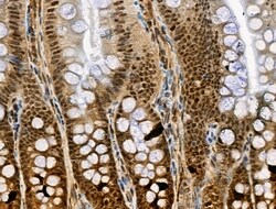 Invitrogen Phospho-ATF6 (Thr166) Polyclonal Antibody 100 &mu;L; Unconjugated:Antibodies,