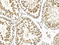 Invitrogen Phospho-ATF6 (Thr166) Polyclonal Antibody 100 &mu;L; Unconjugated:Antibodies,