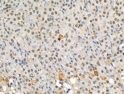 Invitrogen Phospho-ATF6 (Thr166) Polyclonal Antibody 100 &mu;L; Unconjugated:Antibodies,