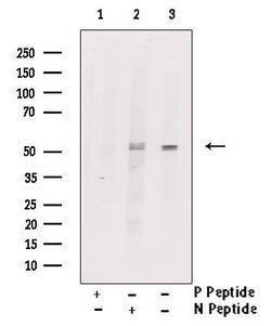 Phospho-RIP3 (Ser316) Polyclonal Antibody, Invitrogen&trade;
