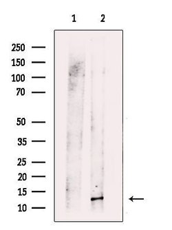 Invitrogen ROC1 Polyclonal Antibody 100 &mu;L; Unconjugated:Antibodies,