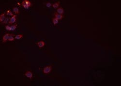 Invitrogen Rad52 Polyclonal Antibody 100 &mu;L; Unconjugated:Antibodies,