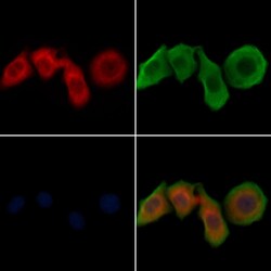 Invitrogen JAK1 Polyclonal Antibody 100 &mu;L; Unconjugated:Antibodies,