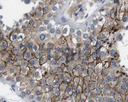 Invitrogen JAK1 Polyclonal Antibody 100 &mu;L; Unconjugated:Antibodies,