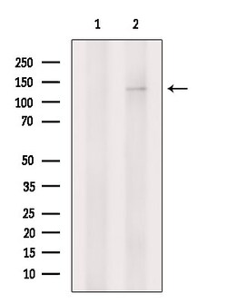Invitrogen JAK1 Polyclonal Antibody 100 &mu;L; Unconjugated:Antibodies,