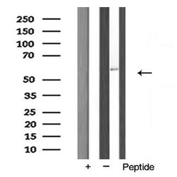 Invitrogen FASTK Polyclonal Antibody 100 μL; Unconjugated:Antibodies,