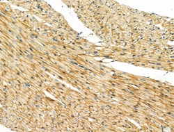 Invitrogen B3GAT1 Polyclonal Antibody 100 &mu;L; Unconjugated:Antibodies,