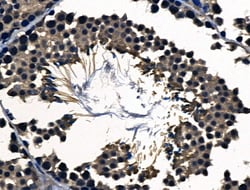 Invitrogen BMP-7 Polyclonal Antibody 100 μL; Unconjugated:Antibodies,