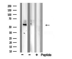 Invitrogen BMP-7 Polyclonal Antibody 100 μL; Unconjugated:Antibodies,