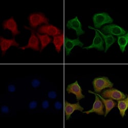 Invitrogen Aquaporin 0 Polyclonal Antibody 100 &mu;L; Unconjugated:Antibodies,