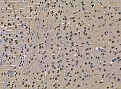 Invitrogen n-Myc Polyclonal Antibody 100 &mu;L; Unconjugated:Antibodies,