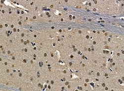 Invitrogen n-Myc Polyclonal Antibody 100 &mu;L; Unconjugated:Antibodies,