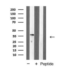 MKP-1 Polyclonal Antibody:Antibodies, Polyclonal