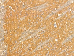 Invitrogen EDG2 Polyclonal Antibody 100 &mu;L; Unconjugated:Antibodies,