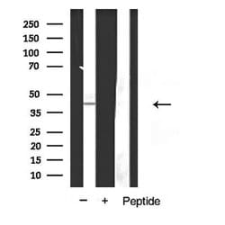 Invitrogen EDG2 Polyclonal Antibody 100 &mu;L; Unconjugated:Antibodies,