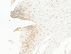 Invitrogen HDAC5 Polyclonal Antibody 100 &mu;L; Unconjugated:Antibodies,