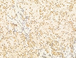 Invitrogen HDAC5 Polyclonal Antibody 100 &mu;L; Unconjugated:Antibodies,