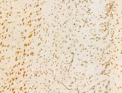 Invitrogen HDAC5 Polyclonal Antibody 100 &mu;L; Unconjugated:Antibodies,