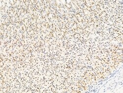 Invitrogen HDAC5 Polyclonal Antibody 100 &mu;L; Unconjugated:Antibodies,
