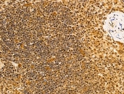 Invitrogen HDAC5 Polyclonal Antibody 100 &mu;L; Unconjugated:Antibodies,
