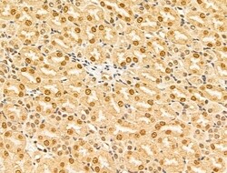 Invitrogen HDAC5 Polyclonal Antibody 100 &mu;L; Unconjugated:Antibodies,