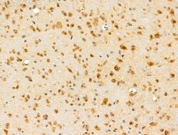 Invitrogen HDAC5 Polyclonal Antibody 100 &mu;L; Unconjugated:Antibodies,