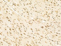 Invitrogen HDAC5 Polyclonal Antibody 100 &mu;L; Unconjugated:Antibodies,