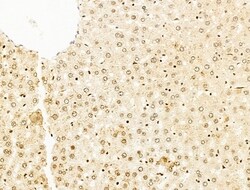 Invitrogen HDAC5 Polyclonal Antibody 100 &mu;L; Unconjugated:Antibodies,