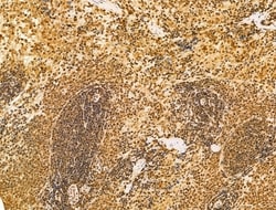 Invitrogen HDAC5 Polyclonal Antibody 100 &mu;L; Unconjugated:Antibodies,
