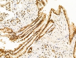 Invitrogen HDAC5 Polyclonal Antibody 100 &mu;L; Unconjugated:Antibodies,