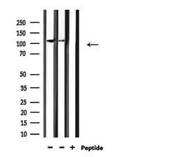 Invitrogen HDAC5 Polyclonal Antibody 100 &mu;L; Unconjugated:Antibodies,