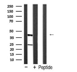 Caspase 4 Precursor (Cleaved Gln81) Polyclonal Antibody, Invitrogen 100