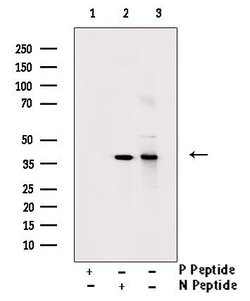 Invitrogen Phospho-Cyclin H (Thr315) Polyclonal Antibody 100 μL; Unconjugated:Antibodies,
