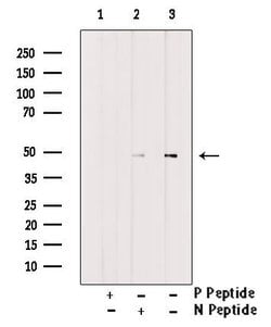 Invitrogen Phospho-IKK gamma (Ser85) Polyclonal Antibody 100 &mu;L | Buy Online | Invitrogen&trade; | Fisher Scientific