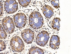 Invitrogen SIAH2 Polyclonal Antibody 100 &mu;L; Unconjugated:Antibodies,