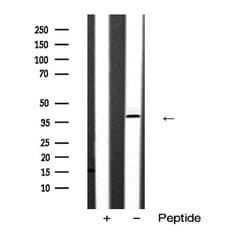 Invitrogen SIAH2 Polyclonal Antibody 100 &mu;L; Unconjugated:Antibodies,