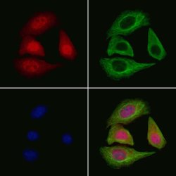Invitrogen IKK alpha/beta Polyclonal Antibody 100 &mu;L; Unconjugated:Antibodies,