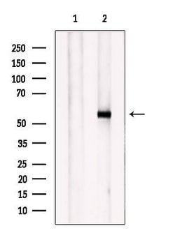 Invitrogen GABRB1 Polyclonal Antibody 100 μL; Unconjugated:Antibodies,