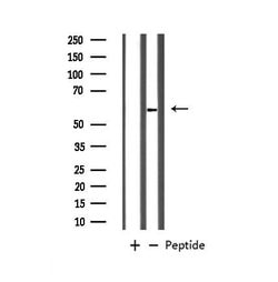 Invitrogen GABRB1 Polyclonal Antibody 100 μL; Unconjugated:Antibodies,