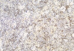 Invitrogen AMPK alpha Polyclonal Antibody 100 &mu;L | Buy Online | Invitrogen&trade; | Fisher Scientific