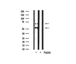 Invitrogen CaMKII beta/gamma/delta Polyclonal Antibody 100 &mu;L; Unconjugated:Antibodies,