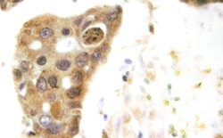 Invitrogen HDAC5 Polyclonal Antibody 100 &mu;L; Unconjugated:Antibodies,