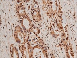 Invitrogen HDAC5 Polyclonal Antibody 100 &mu;L; Unconjugated:Antibodies,
