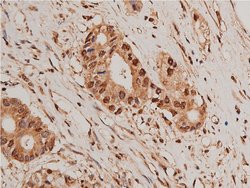 Invitrogen HDAC5 Polyclonal Antibody 100 &mu;L; Unconjugated:Antibodies,