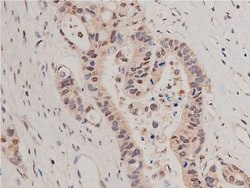 Invitrogen HDAC5 Polyclonal Antibody 100 &mu;L; Unconjugated:Antibodies,
