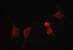TIMP2 Polyclonal Antibody:Antibodies, Polyclonal