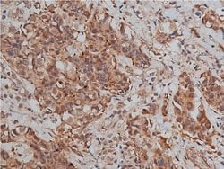 TIMP2 Polyclonal Antibody:Antibodies, Polyclonal
