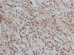 TIMP2 Polyclonal Antibody:Antibodies, Polyclonal